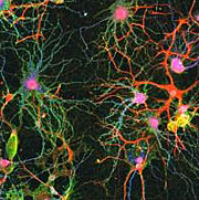 Neuronal connections. Dendrites, which branch from the cell body (pink) of the neuron, play a key role in the communication between cells of the nervous system. Green dendrites contain the STREX form of the BKCa channels. John Eberwine, PhD, University of Pennsylvania School of Medicine